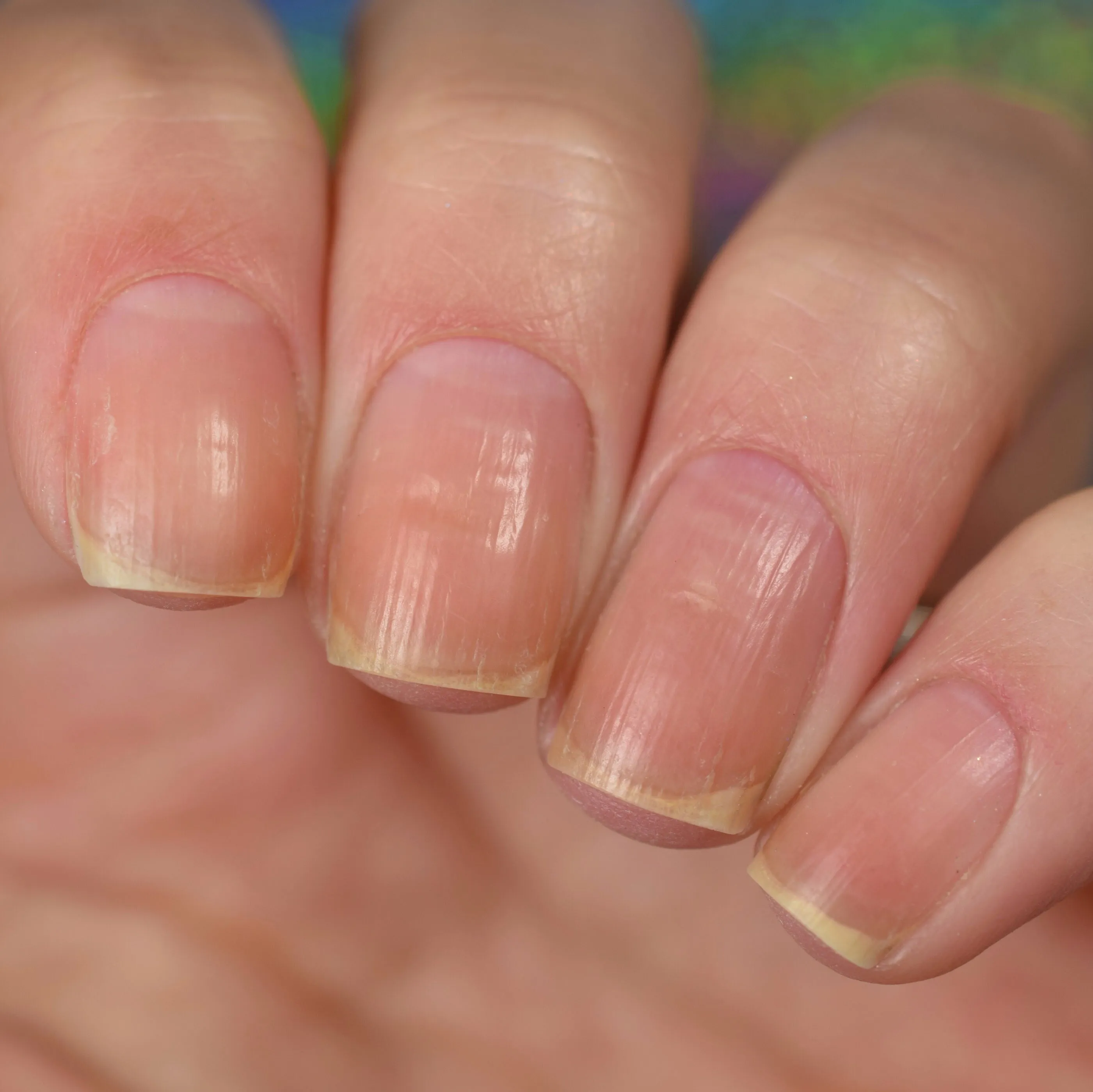 Clean Start Gel Cuticle Remover
